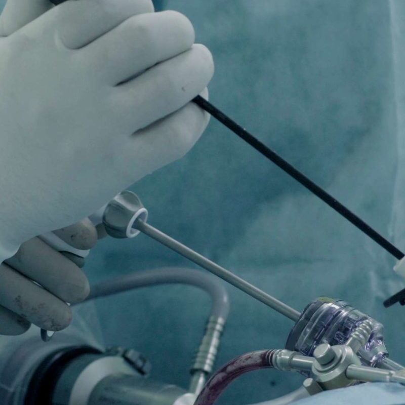 Open & Laparoscopic Surgery